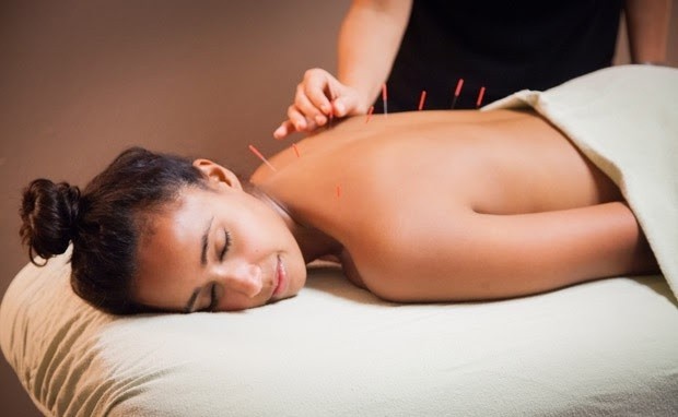 Chữa bệnh không dùng thuốc: Giá trị của châm cứu và dưỡng sinh trong y học cổ truyền