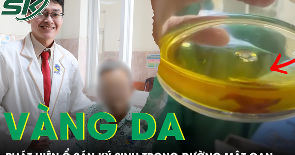 Vàng da, tắc mật do sán ký sinh trong đường mật gan