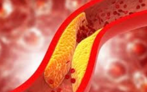 6 loại đồ uống khi bụng đói giúp giảm cholesterol xấu