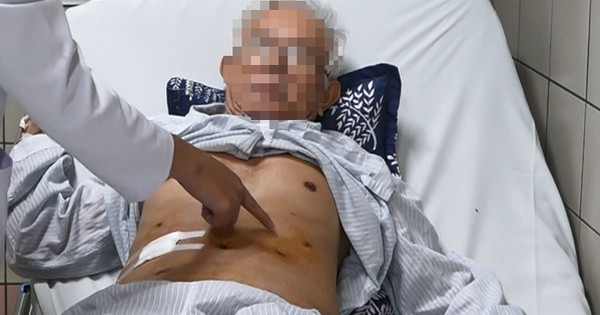 Ung thư có thể tái phát nếu chủ quan sau điều trị