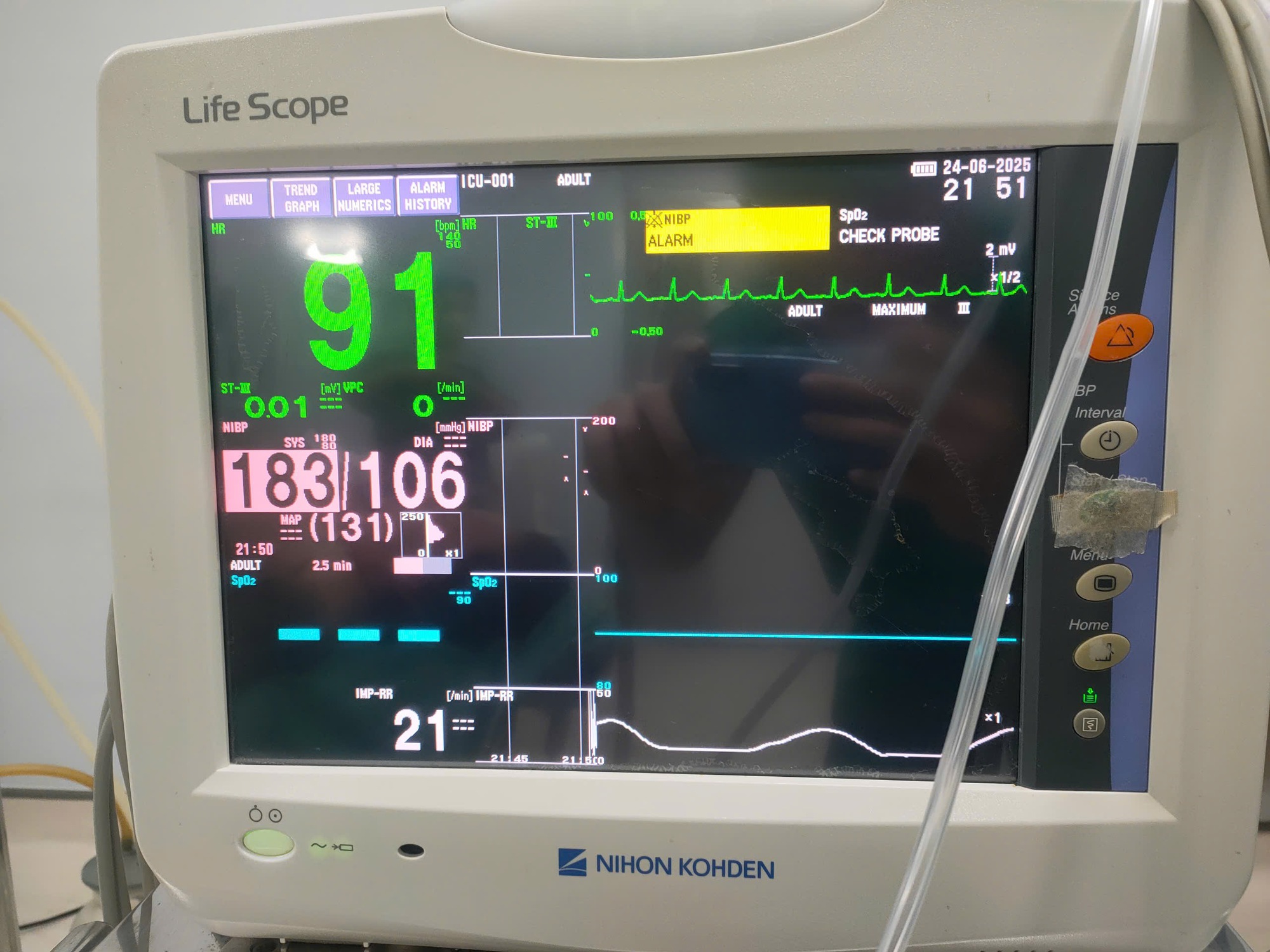 Hiểu đúng về thai kỳ nguy cơ cao để mẹ và bé an toàn- Ảnh 4.