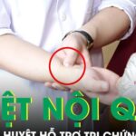 Hướng dẫn cách bấm huyệt nội quan cải thiện mất ngủ