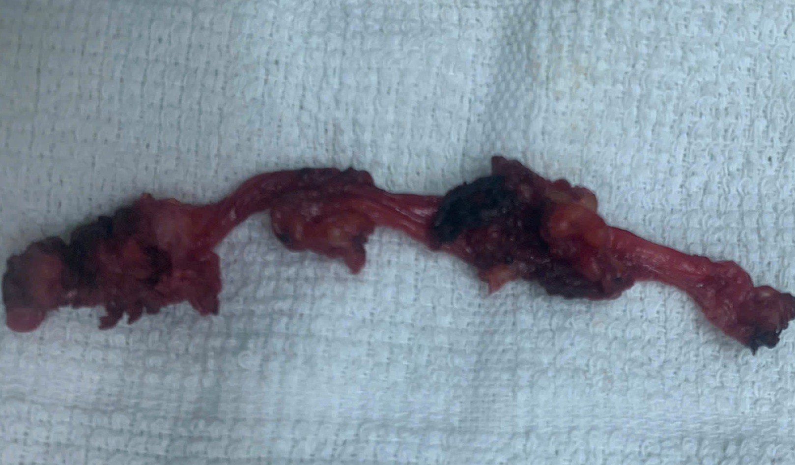 Đau âm ỉ vùng bụng, phát hiện bệnh hiếm nằm sát bàng quang- Ảnh 1.