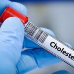 5 biện pháp không dùng thuốc kiểm soát cholesterol cao hiệu quả