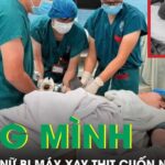 Người phụ nữ phải cắt cụt 4 ngón tay vì bị máy xay thịt cuốn nát