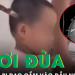 Hai anh em chơi đùa tại nhà, bé 11 tuổi bị dao cắm vào đầu nguy kịch