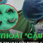 Đeo dị vật kim loại vào vùng kín, người đàn ông 38 tuổi gặp biến chứng nguy hiểm