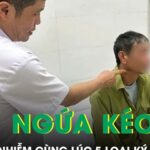 Ngứa suốt nửa năm, người đàn ông phát hiện nhiễm cùng lúc 5 loại ký sinh trùng