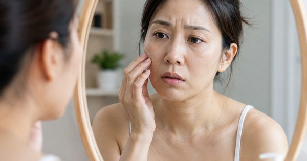 Da chảy xệ sau giảm cân, có nên bổ sung collagen?