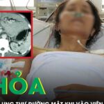Vào viện chăm chồng ung thư gan, người phụ nữ tá hỏa phát hiện mắc ung thư đường mật