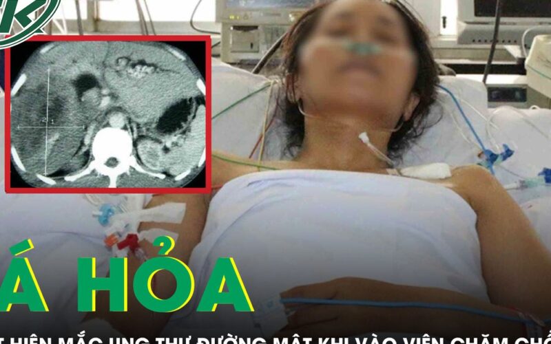 Vào viện chăm chồng ung thư gan, người phụ nữ tá hỏa phát hiện mắc ung thư đường mật