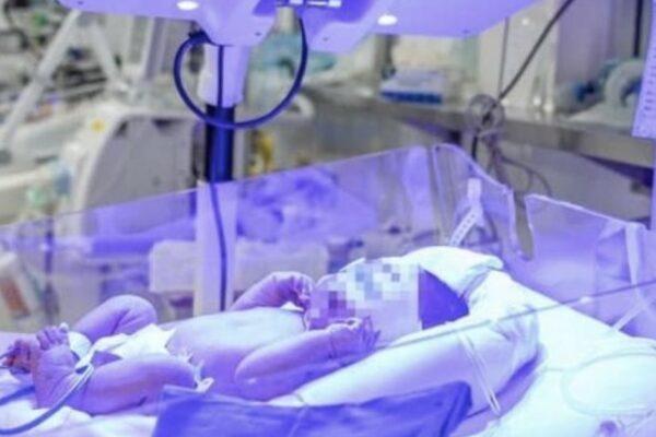 Bé trai sơ sinh mang nhóm ‘máu kim cương’ cực hiếm được cứu sống ngoạn mục