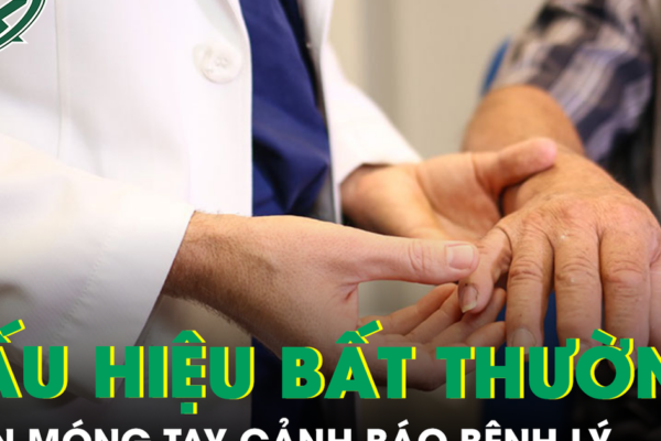 6 dấu hiệu bất thường ở móng tay có thể cảnh báo bệnh lý nguy hiểm