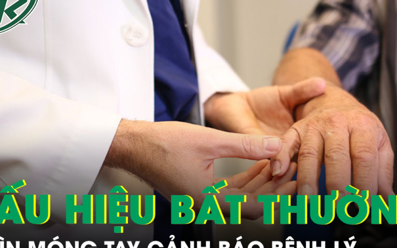 6 dấu hiệu bất thường ở móng tay có thể cảnh báo bệnh lý nguy hiểm