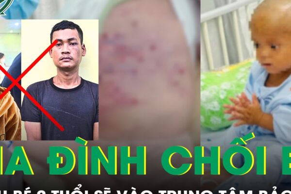 Gia đình chối bỏ chăm sóc, cháu bé 2 tuổi bị mẹ và nhân tình bạo hành sẽ vào trung tâm bảo trợ xã hội