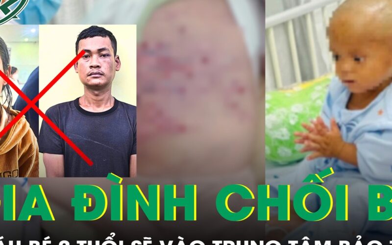 Gia đình chối bỏ chăm sóc, cháu bé 2 tuổi bị mẹ và nhân tình bạo hành sẽ vào trung tâm bảo trợ xã hội