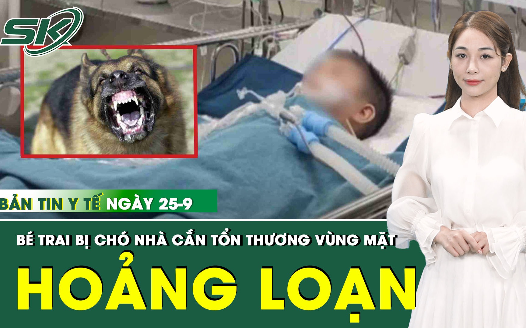 Bản Tin Y Tế 25/9: Bị chó cắn rách vùng mặt khi đang chơi đùa, bé trai hoảng loạn, đau đớn