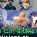 Thai phụ 36 tuần mất gần 10 lít máu, nguy hiểm tính mạng vì tai biến nhau cài răng lược