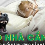 Chó nhà cắn, bé 19 tháng tuổi rách sâu vùng đầu và mặt phải cấp cứu