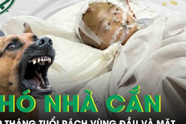 Chó nhà cắn, bé 19 tháng tuổi rách sâu vùng đầu và mặt phải cấp cứu