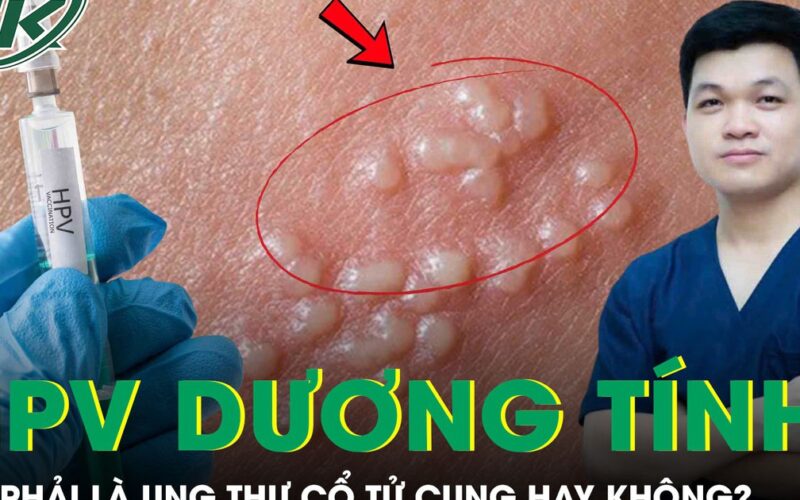 Có phải HPV dương tính là bị ung thư cổ tử cung không?