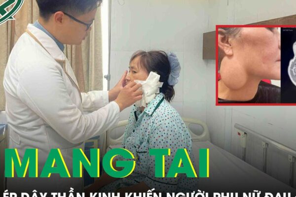 Phẫu thuật u tuyến mang tai chèn ép dây thần kinh, trả lại nụ cười cho người phụ nữ 52 tuổi