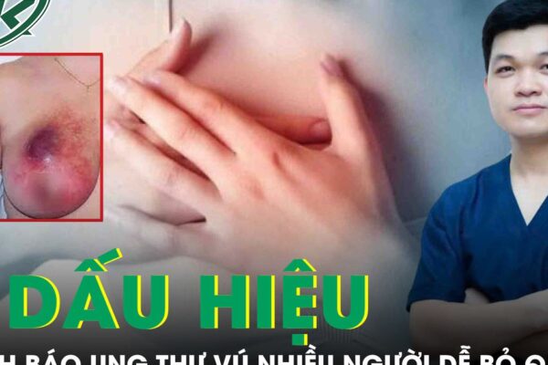 5 dấu hiệu âm thầm cảnh báo ung thư vú nhiều người dễ bỏ qua