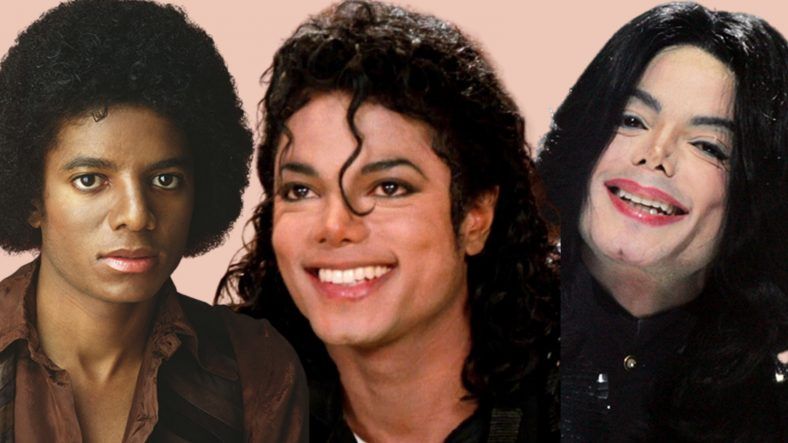 vitiligo-la-causa-de-la-piel-blanca-de-michael-jackson-como-se-volvio-blanco-788x443-1777801098829199406090 Sự thật về căn bệnh hiếm khiến Michael Jackson phải tẩy trắng da- Ảnh 1.