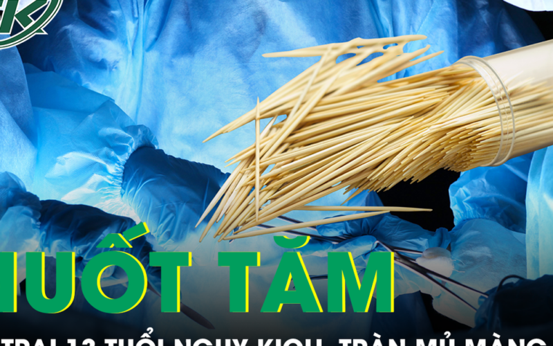 Bé 13 tuổi nguy kịch vì tràn mủ màng tim, bác sĩ sốc khi phát hiện chiếc tăm tre cắm ở tim