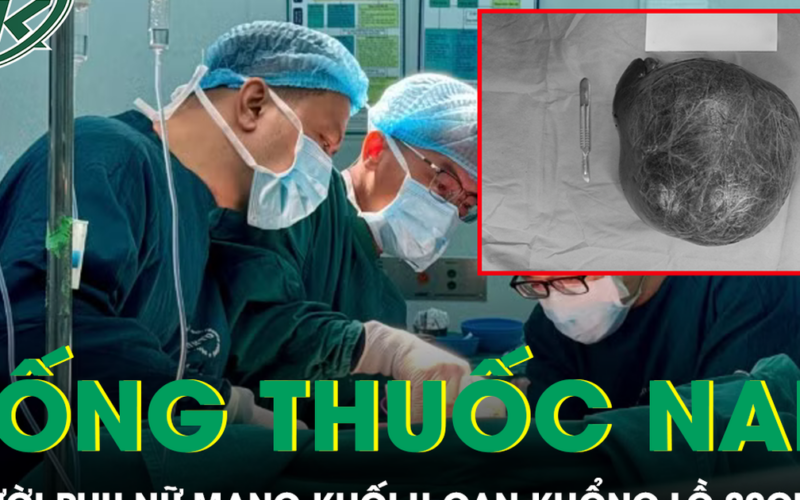 Người phụ nữ mang khối u gan khổng lồ 20cm sau thời gian tự chữa bằng thuốc nam