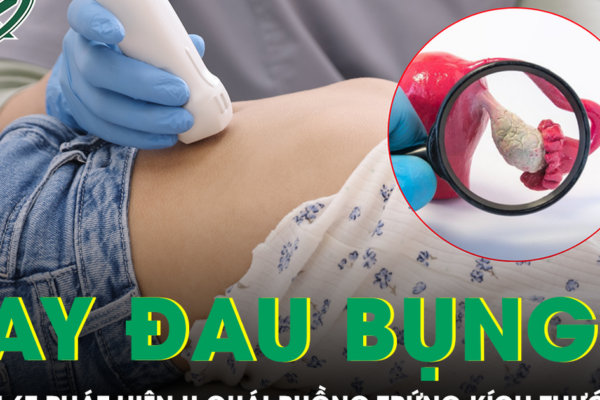 Nhiều lần đau bụng thoáng qua, bé gái 6 tuổi phát hiện u quái buồng trứng kích thước lớn