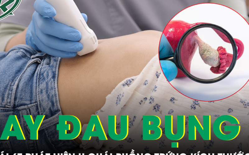 Nhiều lần đau bụng thoáng qua, bé gái 6 tuổi phát hiện u quái buồng trứng kích thước lớn