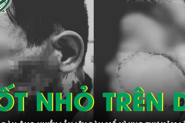 Chủ quan với nốt nhỏ trên da, người đàn ông nhiều lần phẫu thuật ung thư xâm lấn tái phát