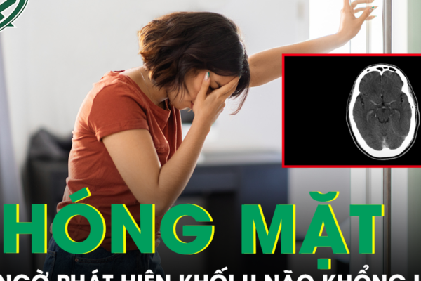 Chóng mặt xây xẩm, người phụ nữ bất ngờ phát hiện khối u não khổng lồ