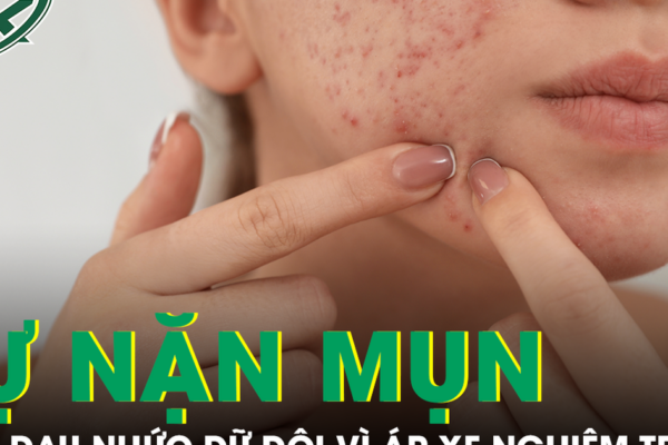 Tự nặn mụn quanh môi, cô gái nhập viện vì áp xe mặt, nhiễm vi khuẩn kháng thuốc