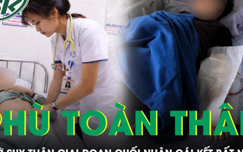 Phù toàn thân, ngỡ suy thận giai đoạn cuối, nam thanh niên 21 tuổi nhận cái kết bất ngờ