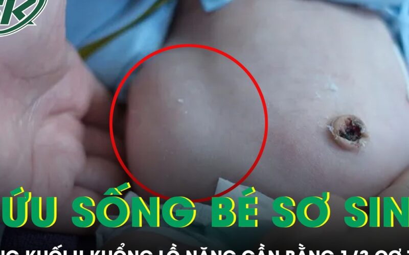 Cứu sống bé sơ sinh mang khối u khổng lồ nặng gần bằng 1/3 cơ thể
