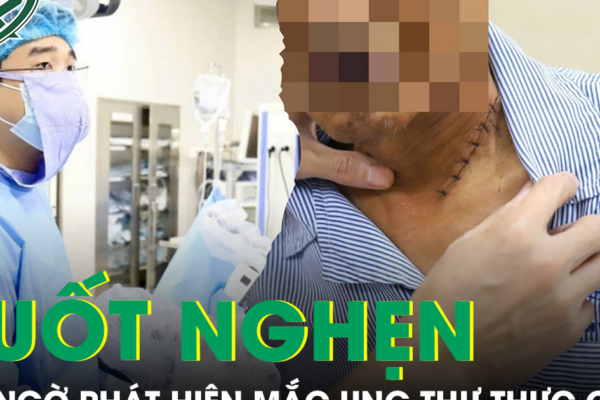 Nuốt nghẹn khi ăn, không ngờ phát hiện mắc ung thư thực quản xâm lấn nguy hiểm