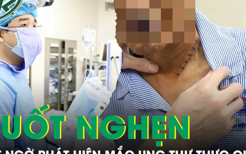 Nuốt nghẹn khi ăn, không ngờ phát hiện mắc ung thư thực quản xâm lấn nguy hiểm