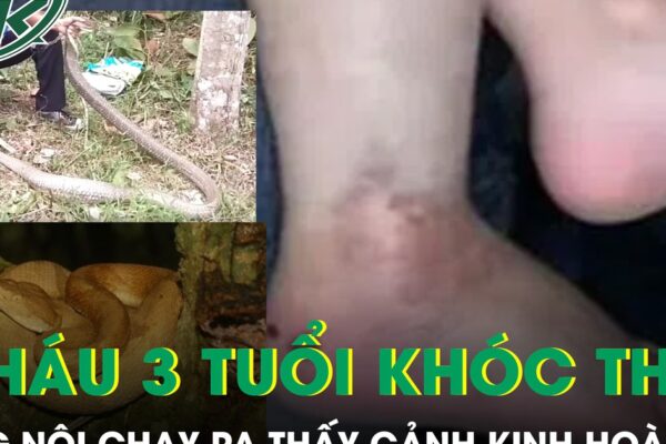 Nghe cháu trai 3 tuổi khóc thét, ông nội chạy ra phát hiện cảnh kinh hoàng bên vườn rau