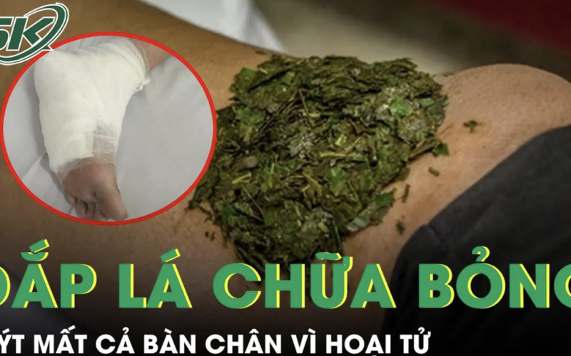 Đắp lá chữa bỏng, người đàn ông tiểu đường suýt mất cả bàn chân