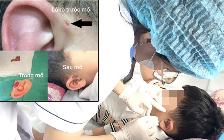Mèo con cắn chủ rồi chết, chủ nuôi mới chịu đi tiêm phòng dại- Ảnh 4.