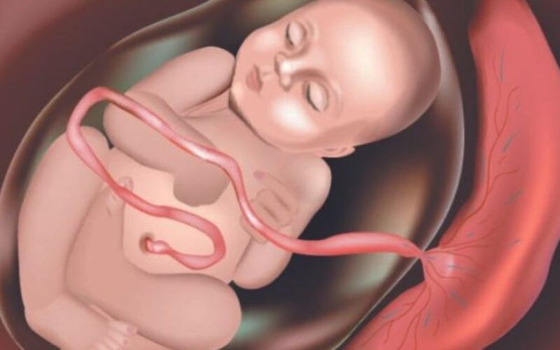 Cảnh báo nhau cài răng lược ở phụ nữ mang thai