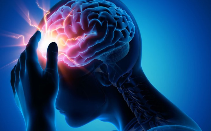 Nguy hiểm khi dấu hiệu đột quỵ xuất hiện rồi biến mất trong vài phút- Ảnh 3.