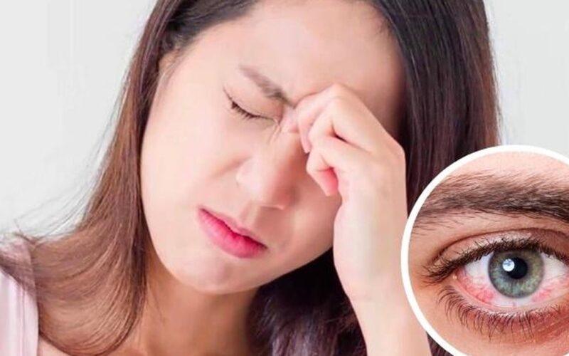 Đau hốc mắt cảnh báo bệnh gì?