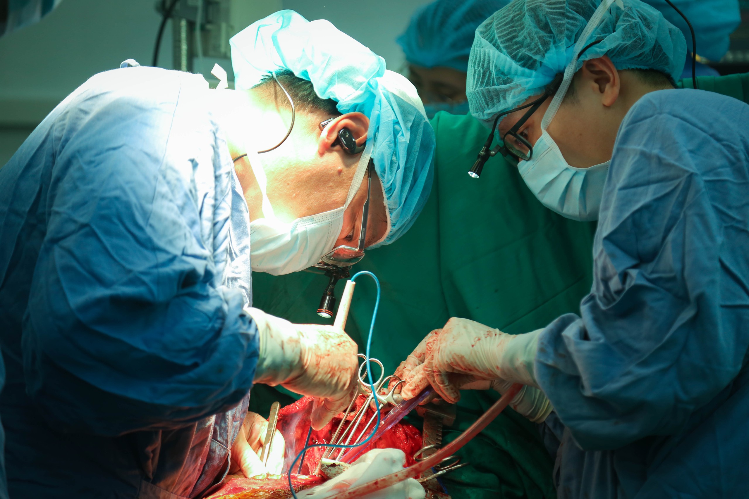 Kỳ tích ghép tạng tại Việt Đức: 21 ca trong một tuần, viết tiếp hành trình hồi sinh- Ảnh 2.