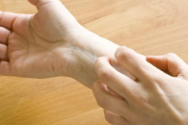 Cải thiện tình trạng ngứa ở người bệnh tiểu đường