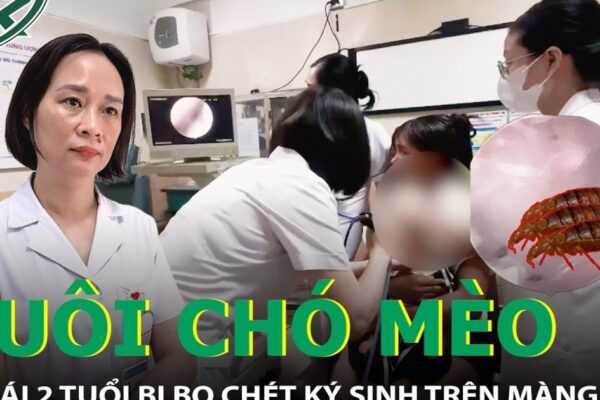 Nuôi chó mèo trong nhà, bé gái 2 tuổi bị bọ chét ký sinh trên màng nhĩ