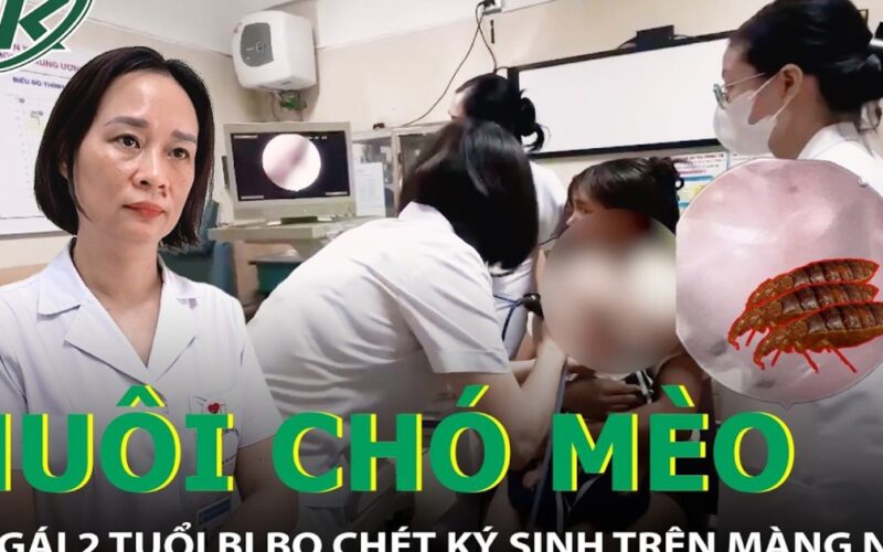 Nuôi chó mèo trong nhà, bé gái 2 tuổi bị bọ chét ký sinh trên màng nhĩ