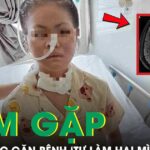 Nữ sinh 19 tuổi mắc căn bệnh ‘tự làm hại mình’ hiếm gặp